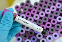 Somalia oo loogu deeqay Malaayiin dollar oo loogu talo galay ka hortaga Coronavirus