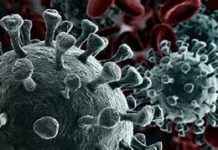 Kiisas la Xiriira Cudurka Covid19 oo laga helay qaybo ka mid ah Soomaaliya