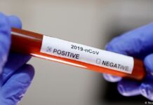 Kiisaska Covid-19 oo u dhaw 300 oo Milyan guud ahaan Caalamka!